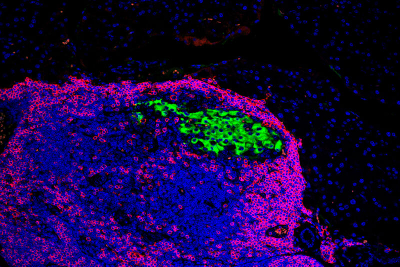 How disabling one gene protects mice against Type 1 diabetes